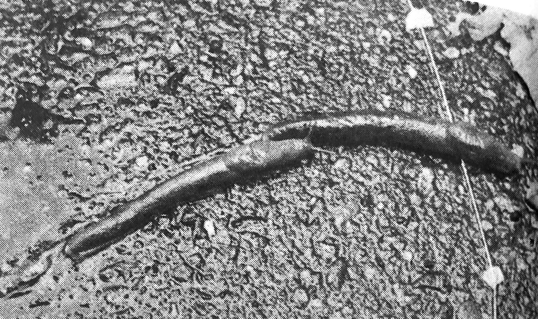 Slug races